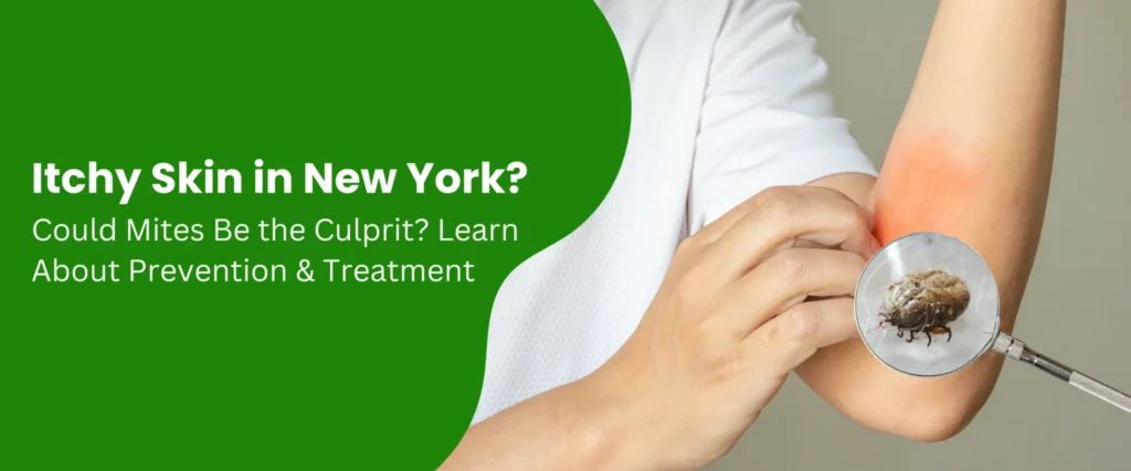 Itchy Skin in New York? Could Mites Be the Culprit? Learn About Prevention & Treatment