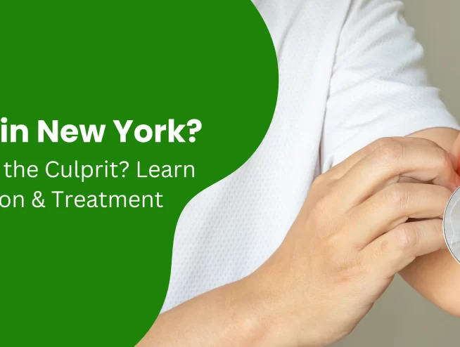Itchy Skin in New York